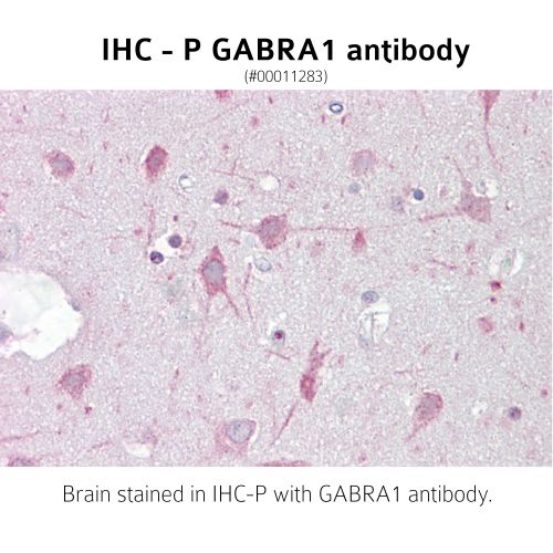 Gamma-aminobutyric-acid receptor alpha-1 subunit (GABRA1) antibody