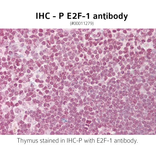 Transcription factor E2F1 acetyl-lysine 120 and 125 (E2F-1) antibody