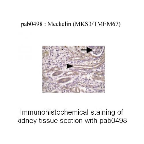 Meckelin antibody