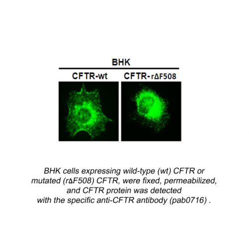 Cystic fibrosis transmembrane conductance regulator (CFTR) antibody