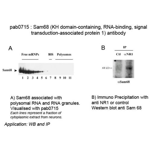 KH domain-containing, RNA-binding, signal transduction-associated protein 1 (Sam68) antibody
