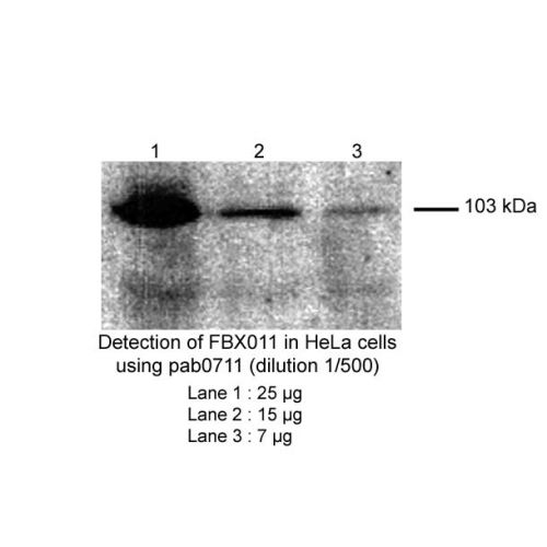 F-box only protein 11 (FBXO11) antibody