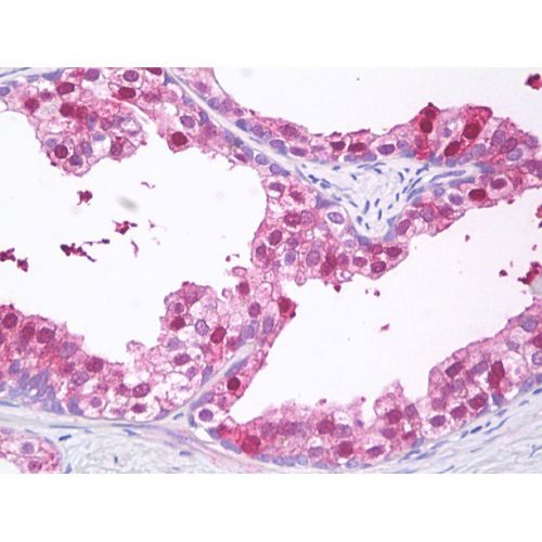 Charged multivesicular body protein 3 (CHMP3) antibody