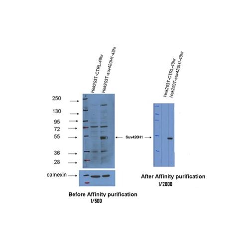 Histone-lysine N-methyltransferase SUV420H1 (Suvari-1) antibody