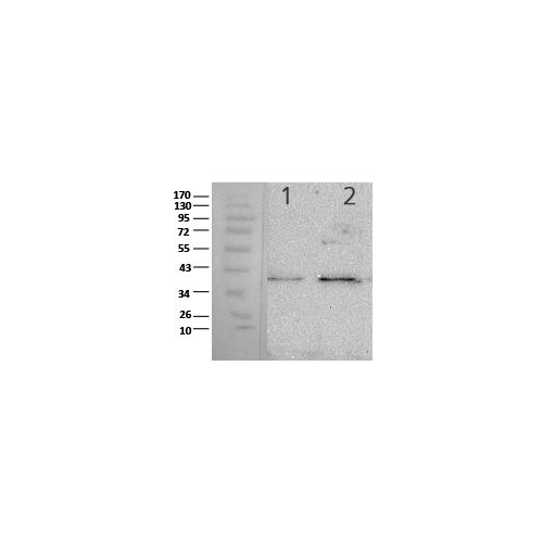 Bacterial Transglutaminase antibody