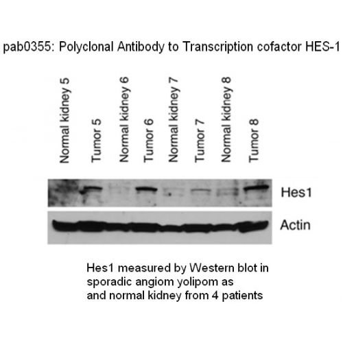 Transcription factor HES-1 antibody