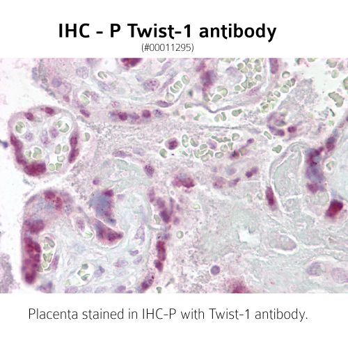 Twist-1 antibody