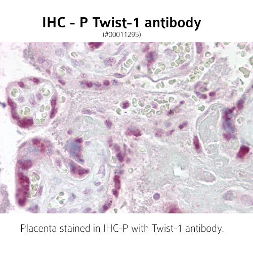 Twist-1 antibody