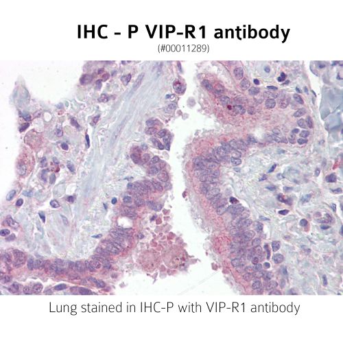 Vasoactive intestinal polypeptide receptor 1 (VIP-R1) antibody