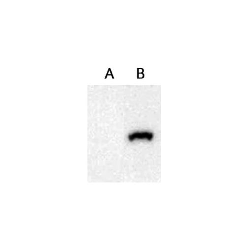 Secretory phospholipase A2 receptor (PLA2R) antibody