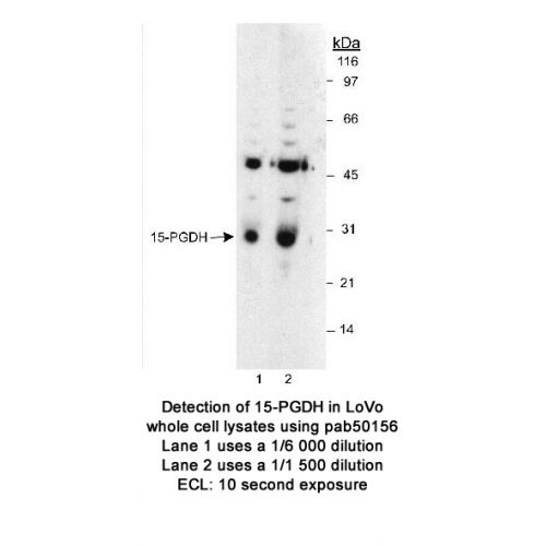 15-PGDH antibody