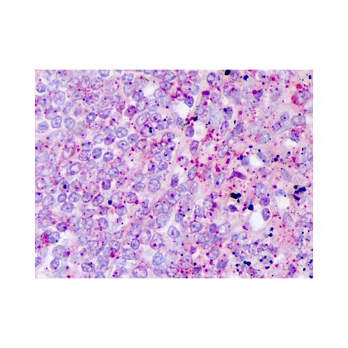 IL-17 antibody