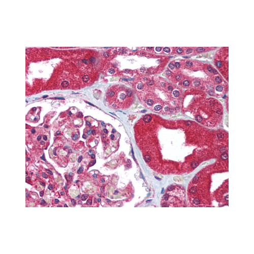 ABCB1 / MDR1 (aa262-277) antibody