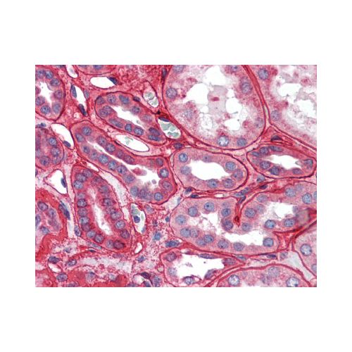 Collagen IV antibody