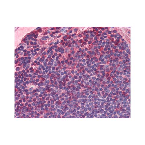 IL-7 Receptor (C-Terminus) antibody