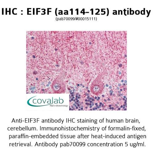 EIF3F (aa114-125) antibody