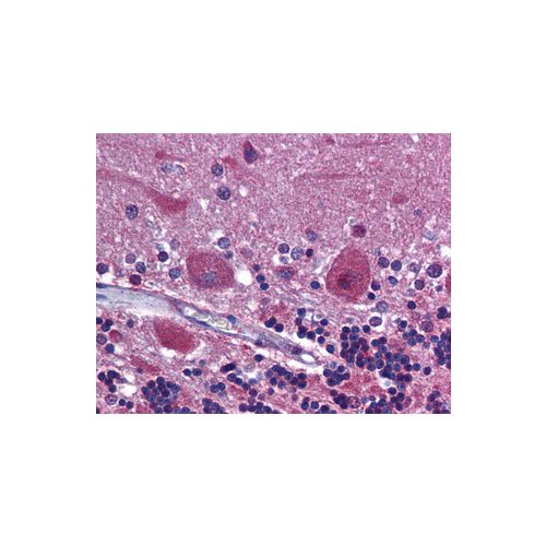 PDGF Receptor Alpha (aa1035-1053) antibody