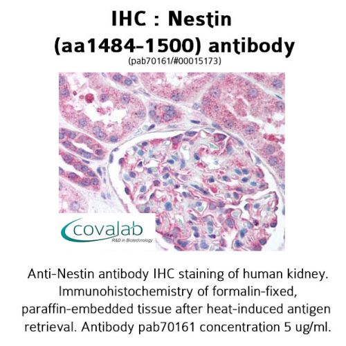 Nestin (aa1484-1500) antibody