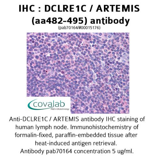 DCLRE1C / ARTEMIS (aa482-495) antibody