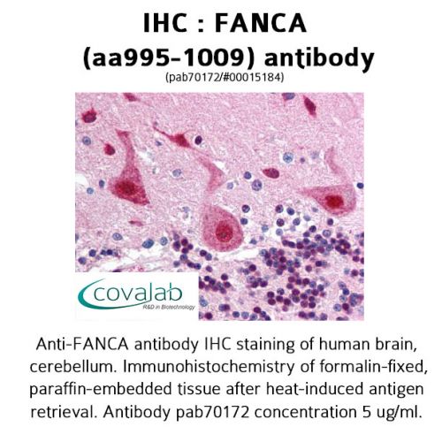 FANCA (aa995-1009) antibody