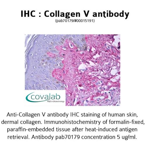 Collagen V antibody