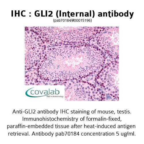 GLI2 (Internal) antibody