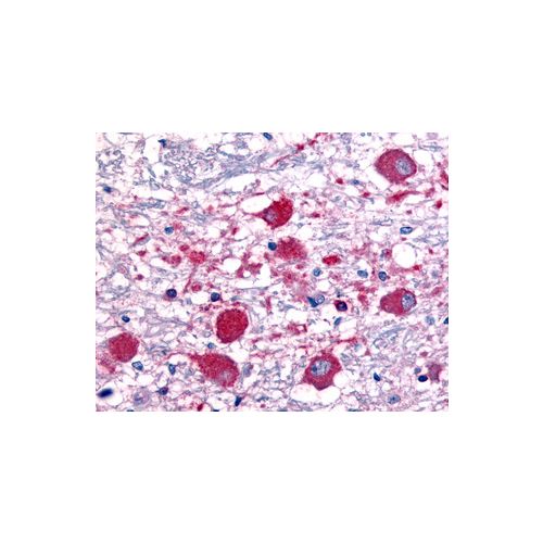 ROBO1 (aa1632-1644) antibody