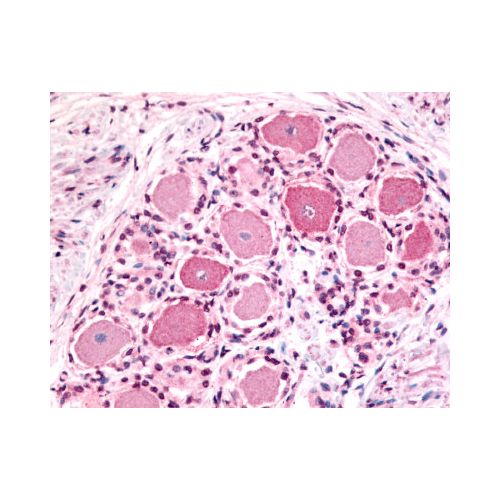 5HT1D Receptor (N-Terminus) antibody