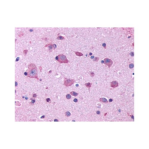 5HT2B Receptor (Extracellular Domain) antibody