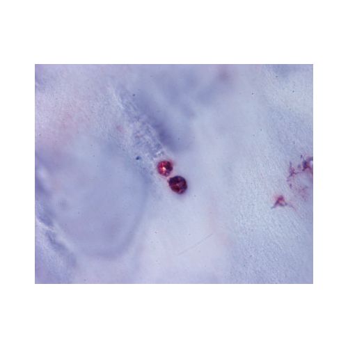 ACAN / Aggrecan (C-Terminus) antibody