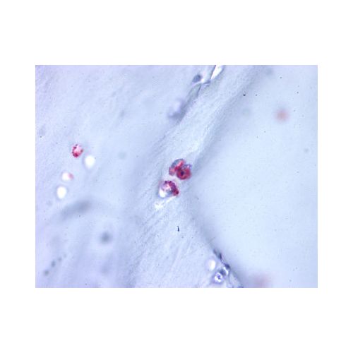 ACAN / Aggrecan (C-Terminus) antibody