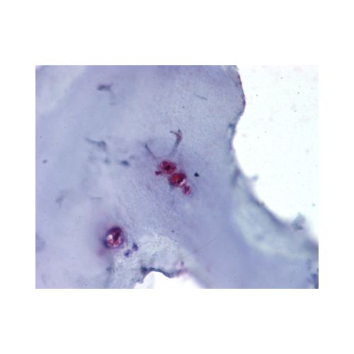 IHC : ACAN / Aggrecan (Internal) antibody<br/>(pab70234)<br/>Anti-ACAN / Aggrecan antibody IHC of human cartilage. Immunohistochemistry of formalin-fixed, paraffin-embedded tissue after heat-induced antigen retrieval.