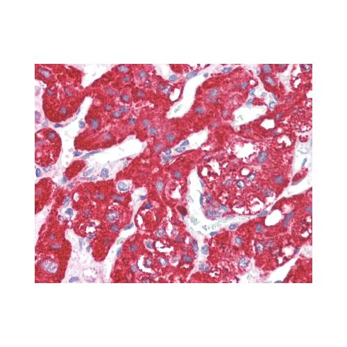 ACVR1 / ALK2 (N-Terminus) antibody