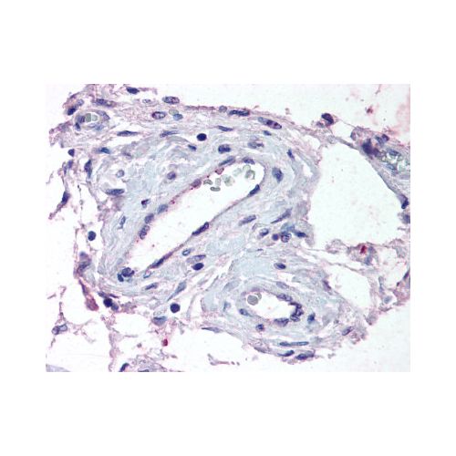 ADAMTS1 (Internal) antibody