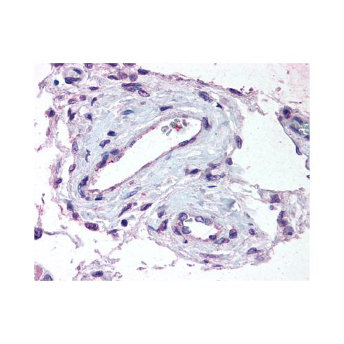 ADAMTS1 (Internal) antibody