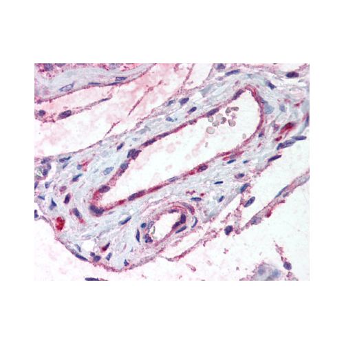 ADAMTS1 (Internal) antibody