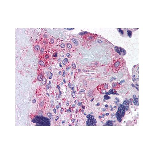 ADAMTS5 (Internal) antibody