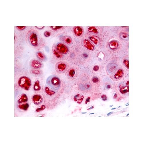 ADAMTS5 (Metalloprotease Domain) antibody