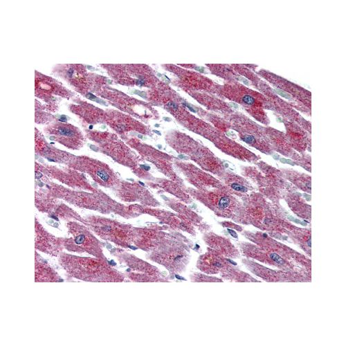 ADCYAP1R1 (N-Terminus) antibody