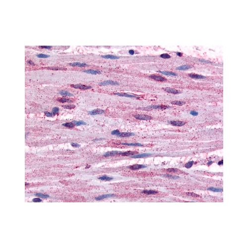 ADRA1B (Cytoplasmic Domain) antibody
