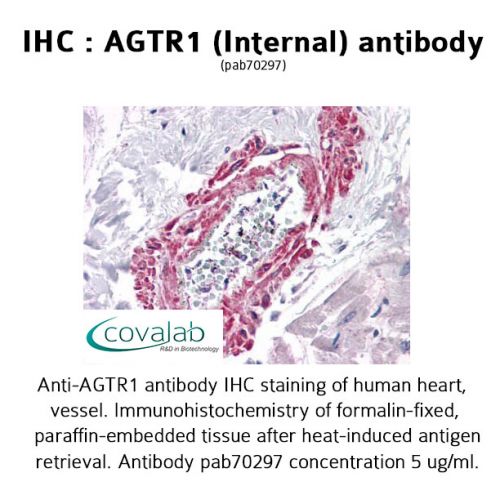AGTR1 (Internal) antibody