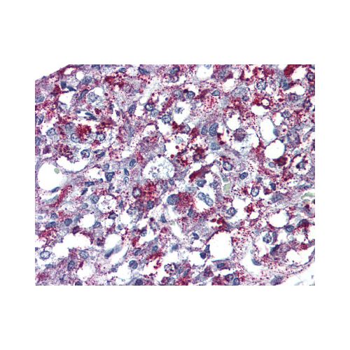 AGTR2 (Internal) antibody