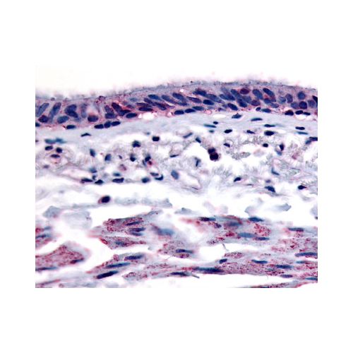 Aryl Hydrocarbon Receptor (C-Terminus) antibody