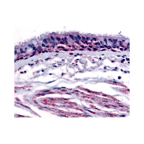 Aryl Hydrocarbon Receptor (Internal) antibody