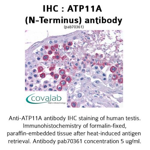 ATP11A (N-Terminus) antibody