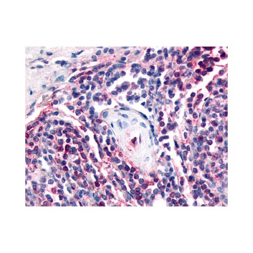 ATRN / Attractin (Internal) antibody