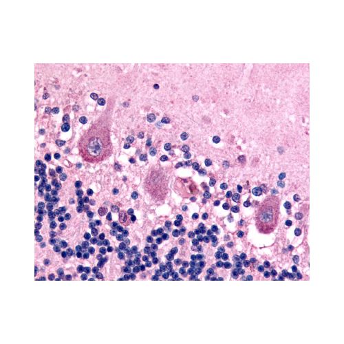 BAI1 (C-Terminus) antibody