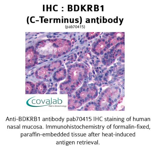 BDKRB1 (C-Terminus) antibody