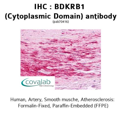BDKRB1 (Cytoplasmic Domain) antibody