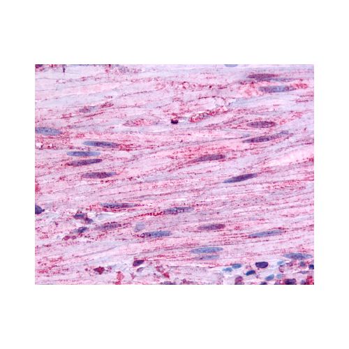 BDKRB1 (Extracellular Domain) antibody